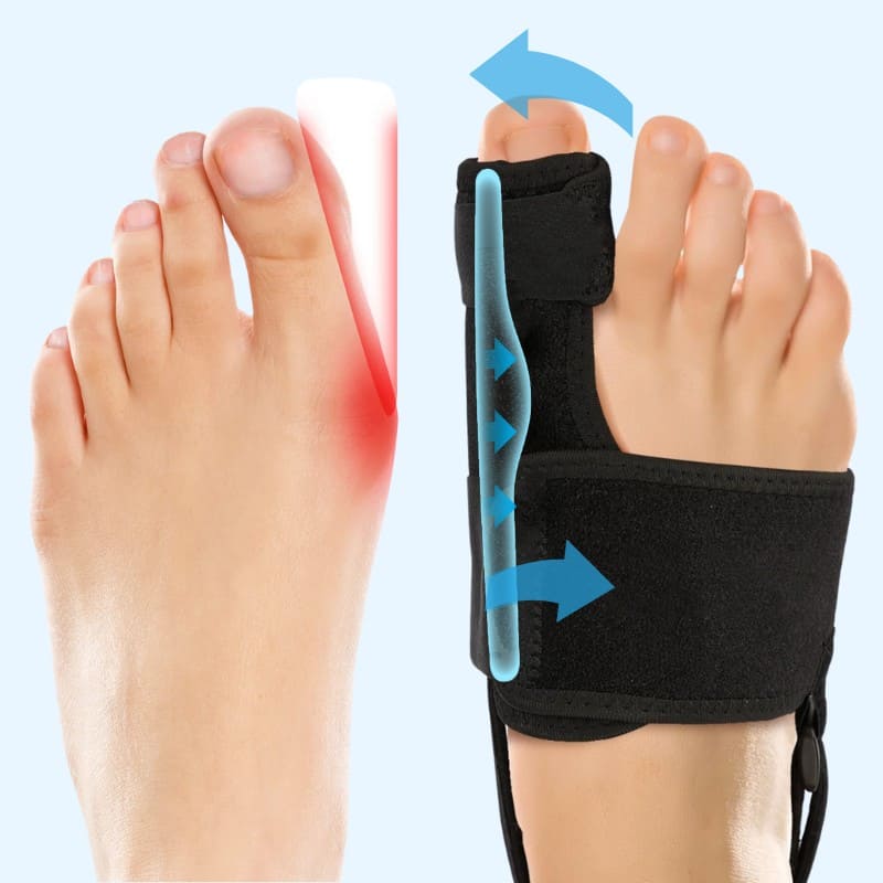 Valgux™ Brace | Bunion Corrector for Big Toe Alignment