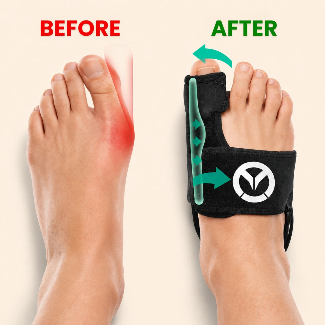 Footrez Bunion Braces